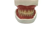 BPS Full acrylic denture